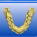미소치과기공소 이미지