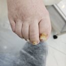 레푸스인천부평씨지브이(CGV)점 | 부평역 내성발톱, 무좀발톱, 발긱질 "레푸스부평CGV점" 솔직후기