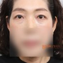 에스에이치(SH)성형외과의원 이미지