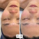 스튜디오올가 | 정관 피부관리 추천, 올가드림뷰티 정관롯데캐슬점 방문 후기