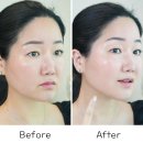 글림 | 뷰티디바이스추천 듀얼소닉 글림빛 피부마사지기 효과 후기