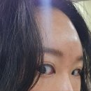 비앤비성형외과