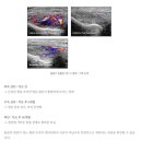 테넥스