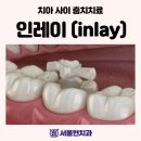 보일치과기공소 이미지