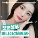 피니쉬성형외과의원 네이버블로그