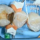 빌드업