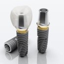 (주)솔리드이엔지 이미지