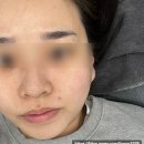 디어닝 | 부산 전포스킨플래닝 디어닝 후기 화장 잘 먹는 피부 만들기