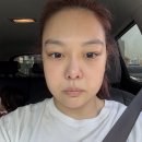 이사검 선생 묘 | 강남역피부과 리쥬엘의원에서 받은 덴서티 후기 (덴서티vs써마지 비교 )