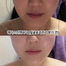 부천윤곽관리 상동역사거리 초근접 피부관리 케이스킨앤바디