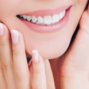 자연치과기공소 이미지