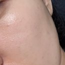 최미경헤어 | 얼굴에 오일을 바른다고? 😒 보타닉 페이스 캐리어오일 일주일 솔직 후기 ✔💚 | 피부 에센스 추천