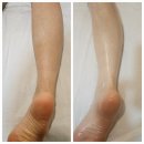오늘더예뻐 | |청주 뷰티| 청주 비하동 에스테틱 ‘내일 더예뻐’ 하체관리 후기