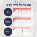 연세단단치과의원 티스토리