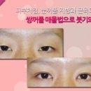 이재경성형외과 이미지