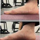 (주)인포메디 | 깔창 추천 효과 내돈내산 후기