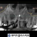 화이트플러스치과 이미지