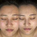 나주 1등 피부 관리 샵 디바스킨 나주본점에서 수분충전하고 온 후기