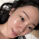 리투오 3회 이상 받아본 후기, 모공 효과 진짜 있을까?