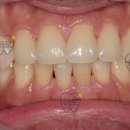 크라운치과기공소 이미지