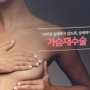 플랜비성형외과의원 이미지
