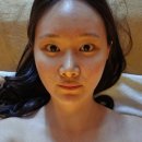 명동피부관리 여드름관리경력20년이상 여드름 자국 집중 관리 예비신부 스와니예 명동 솔직후기