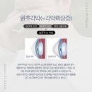 라식 전 눈 검사 후기ㅠㅠㅠㅠ(원추각막, 각막확장증, 스마일라식, 라섹, 검안비, 병원후기)