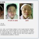 지니홈케어