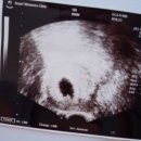 고운맘작은도서관 이미지