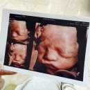 해피니手(수)- 손에 잡히는 행복 | 잊기전에 남겨보는 둘째 임신, 출산후기..☺️(feat. 조기진통, 조기출산)