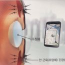 칼자이스비전코리아(주) 이미지