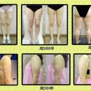 정메디칼 이미지