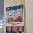 내돈내산 경기광주 문제성발관리 잘 하는 곳 " 레푸스 경기광주경안점 "