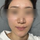리쥬란 가격 부담된다면? 12월 예신이 발품 팔아 찾은 '구리역 미주란'내돈내산 후기