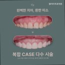 갤러리치과의원 이미지