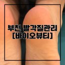 드림케어비케이 | 부천 신중동역 [바이오뷰티] 발각질제거 후기 무좀 문제성발 관리