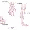월오사암침, 가래톳이 선다, 서혜부 임파절염, 서혜부 통증 치료 이미지