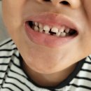 처음가는소아치과의원 이미지