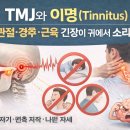 TMJ와 이명(Tinnitus) 턱관절·경추·근육 긴장이 귀에서 나는 소리로 이어지는 이유 이미지