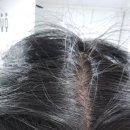 자연유기농(최백규) | 분당두피관리 수내 두피밥 분당점 : 30대 중반 정수리 탈모 고민, 유기농 스케일링으로 광명 찾은 후기