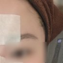 필한의원 | [끗한의원]부평 아쿠아필 후기