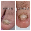 라룸네일