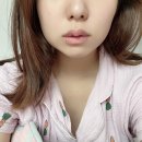 화인치과병원 | 창원 화인치과 사랑니 발치 후기