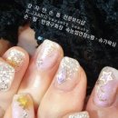 강자안손톱