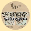 강민정헤어샵 | 잠실 더모어스칼프에서 받고 온 남자 두피와 승모 케어 과정 및 후기