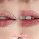 립라인 반영구 고유브로우 후기