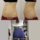 리즈라인의원 이미지