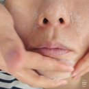피코네일 - 서구 월평동로26번길 37 | 안산 에스테틱 피코 토닝 관리받은 후기 - 더맑은에스테틱