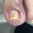 경기도 수원시 권선구 덕영대로1031번길 1 (세류동) | 수원 세류동 매교동 내성발톱 부모님 모시고 가기 좋은 코지네일 오벨리네일푸스 족보있는그녀들 수원역점