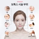 청담엠에스의원 | 보톡스 14년 차 찐 후기